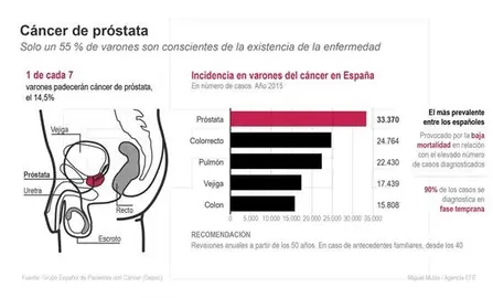 El perfil del paciente de pr&oacute;stata se rejuvenece